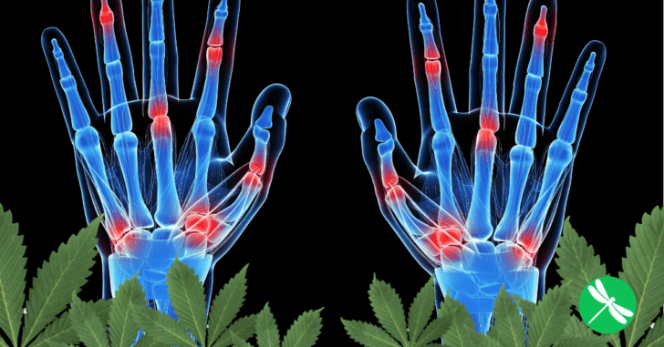 Could Cannabis Be Used To ‘Repair’ Damage To Arthritic Joints? Science Is Saying Yes